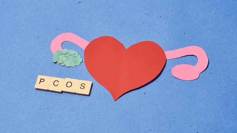 What Is PCOS Disease? 6 Essential Facts About PCOS You Need To Know To Manage Your Symptoms