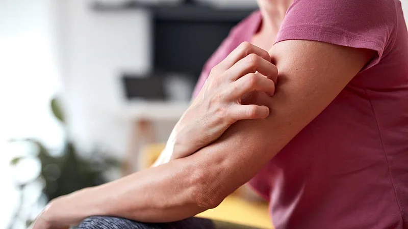 5 Histamine Intolerance Symptoms You Need to Know, What it is, and How Patches Could Help: