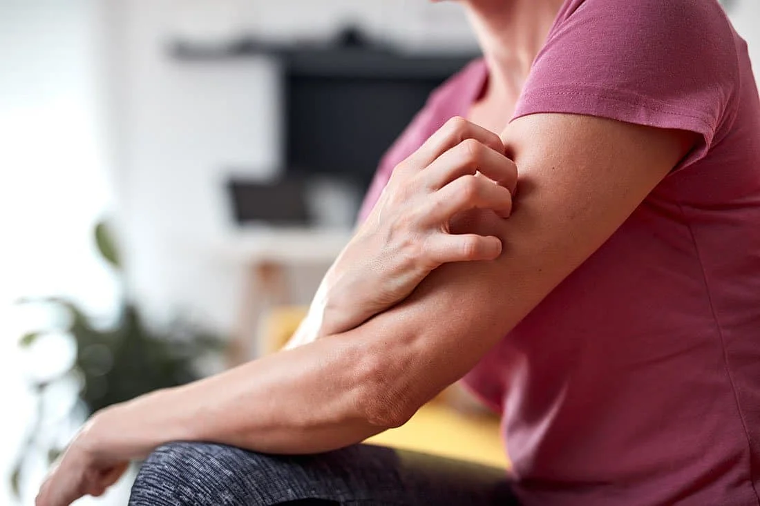 5 Histamine Intolerance Symptoms You Need to Know, What it is, and How Patches Could Help: